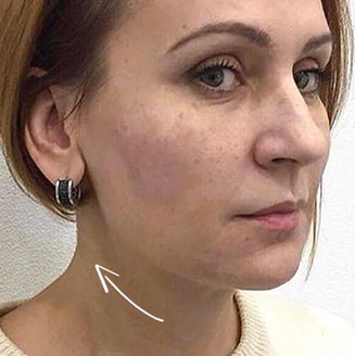 Після відновлення